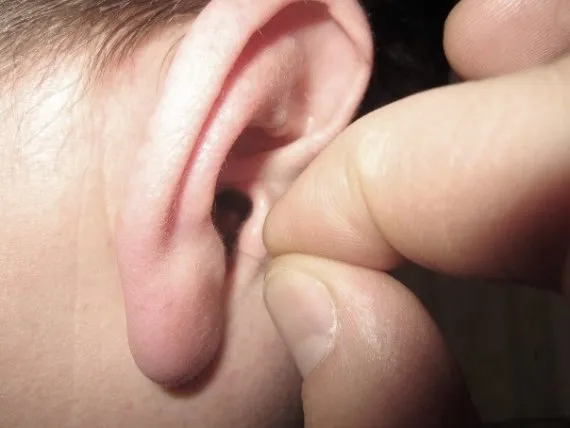 Как выглядит капсульный микронаушник в ухе