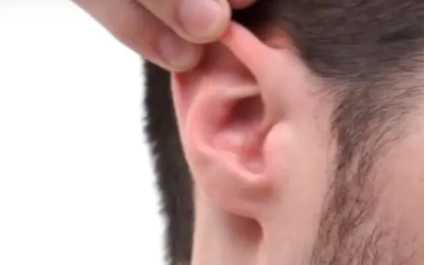 Оттягивается верхняя часть уха